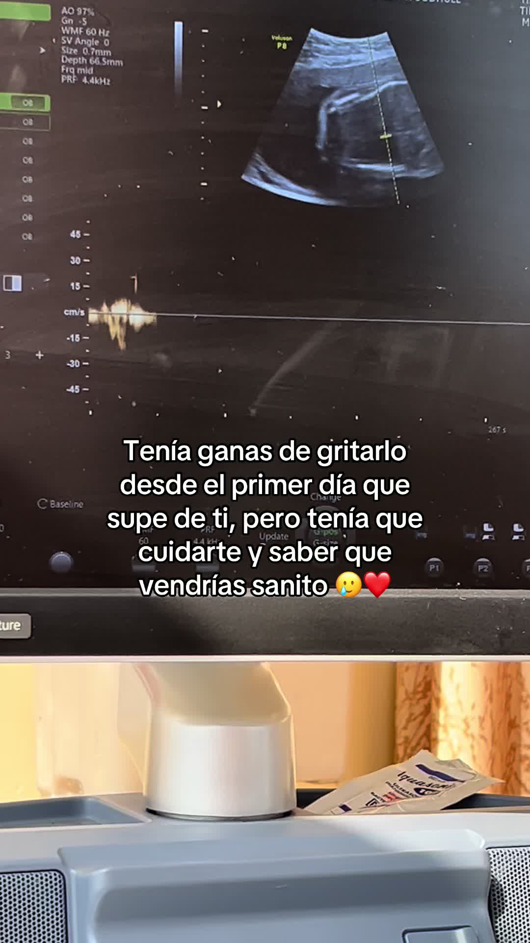 @Monica Miniguano