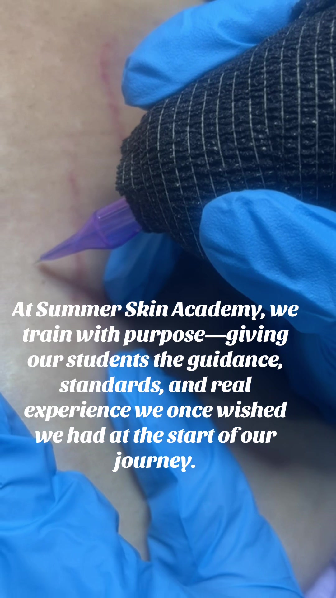 @Summer Skin Clinic | Toronto