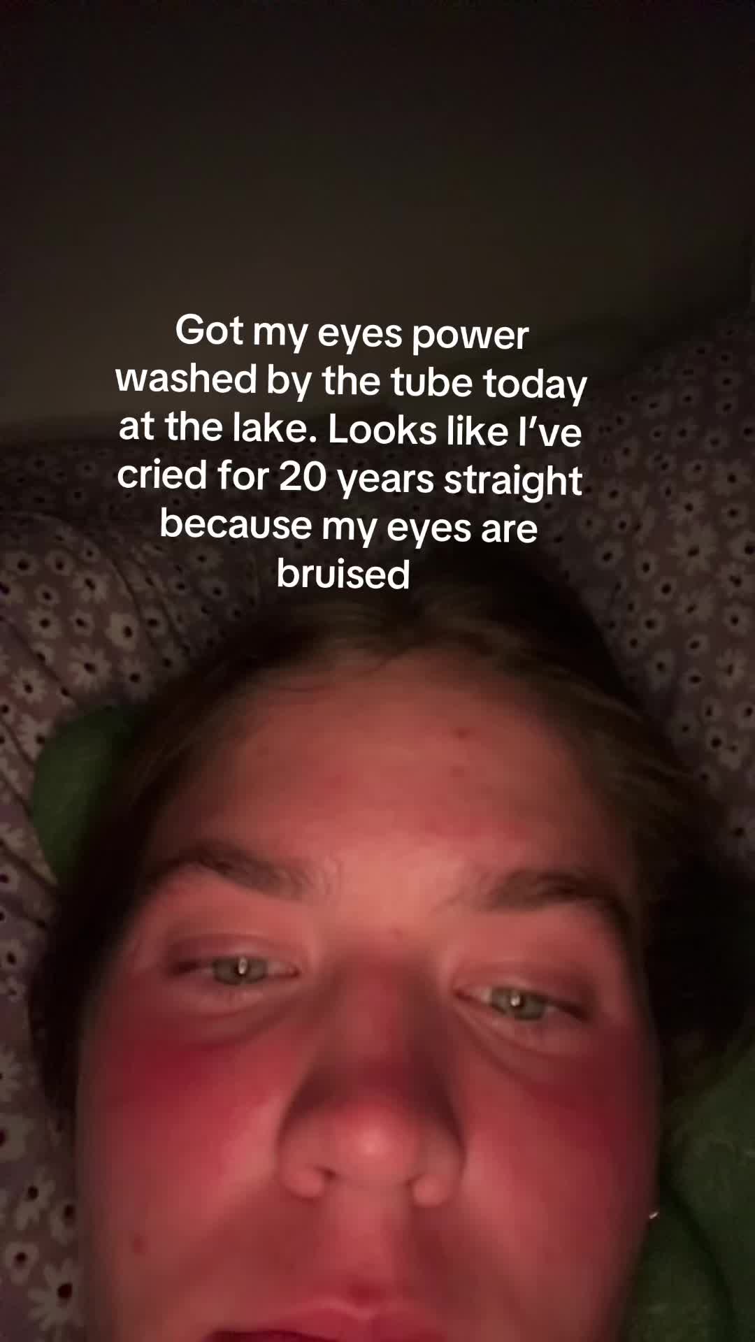 @Addy