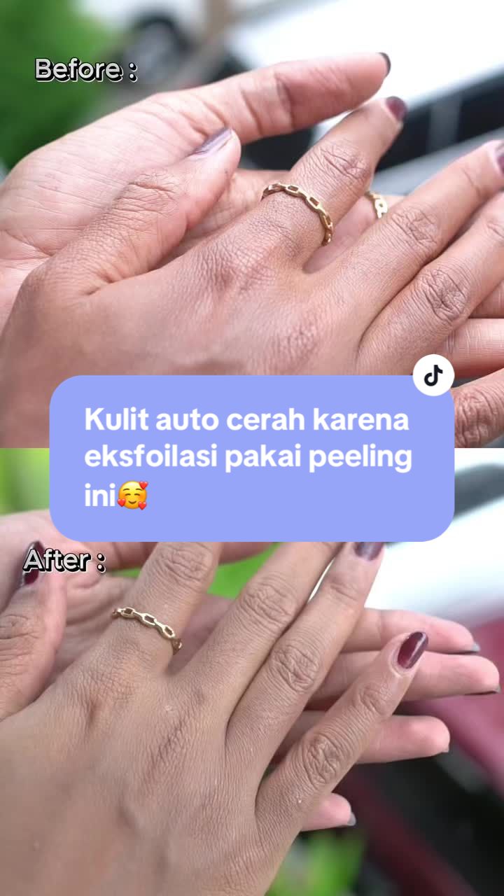 @intenskin