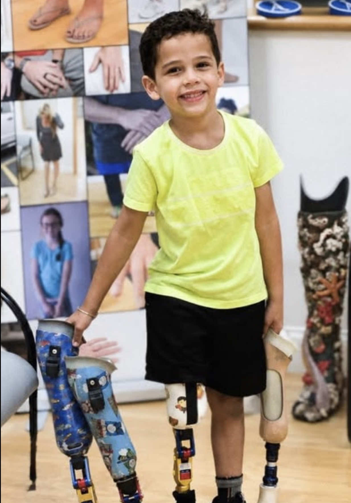@A Step Ahead Prosthetics
