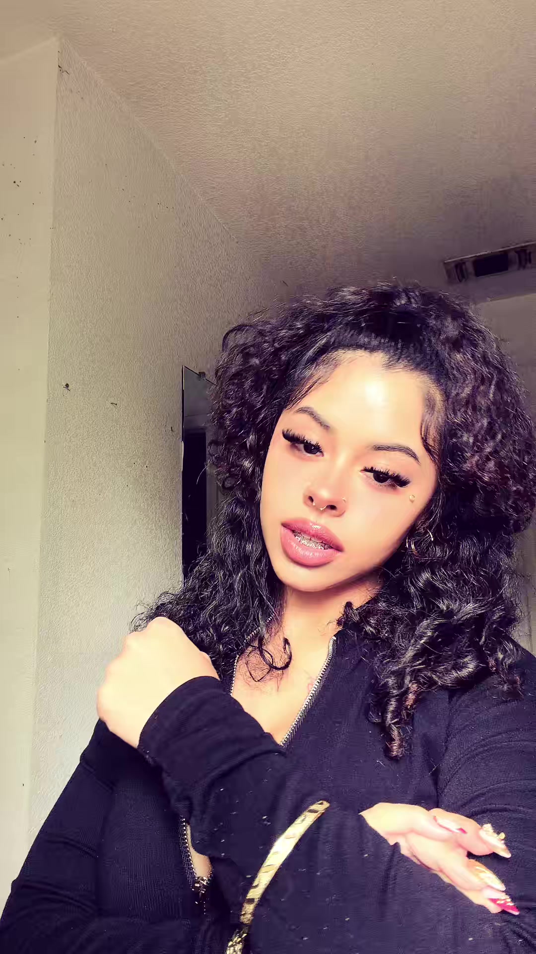 @777