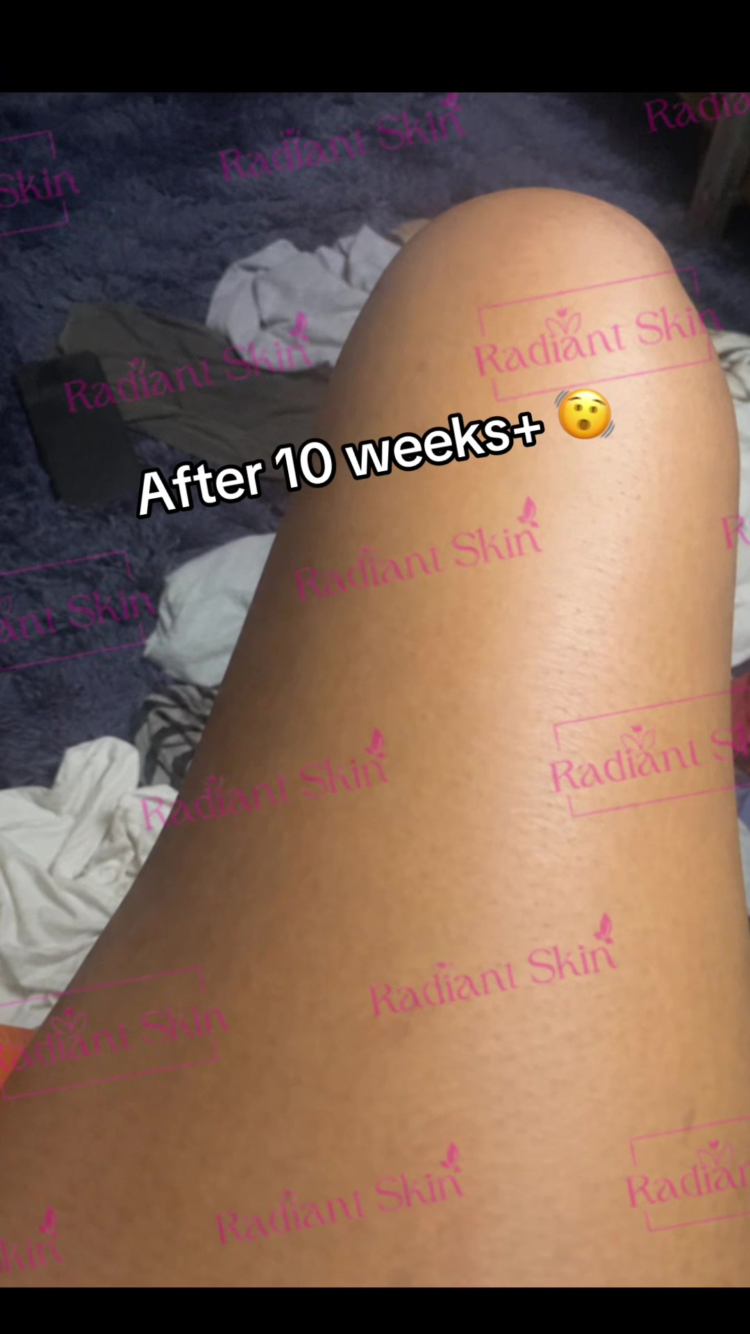 @Radiant skin