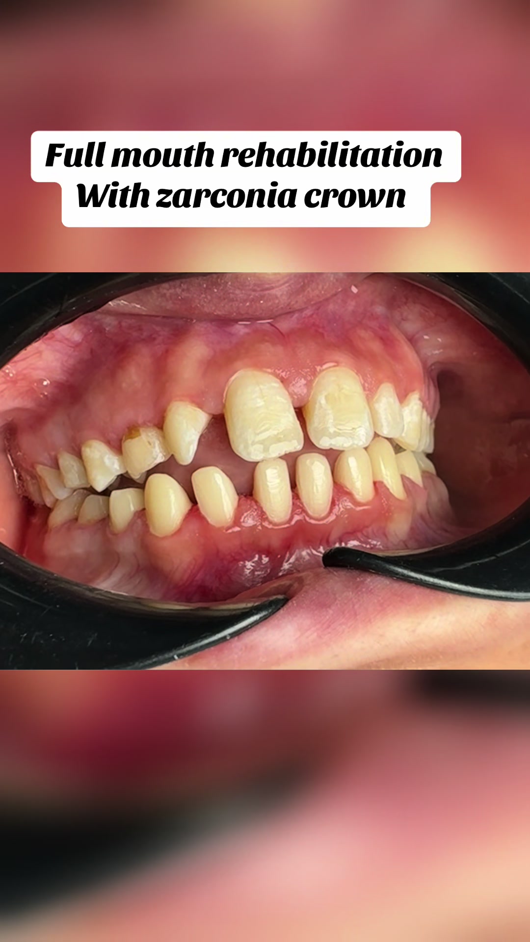 @Dr RahmatullahDental surgeon