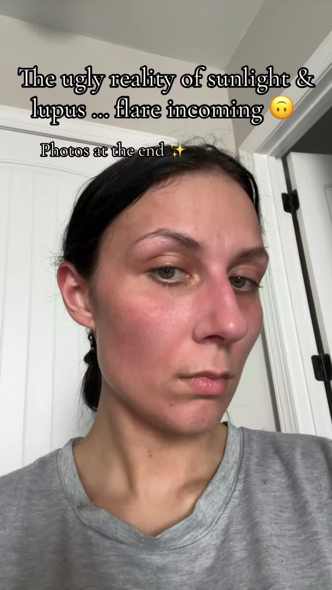 @EMKULTRA