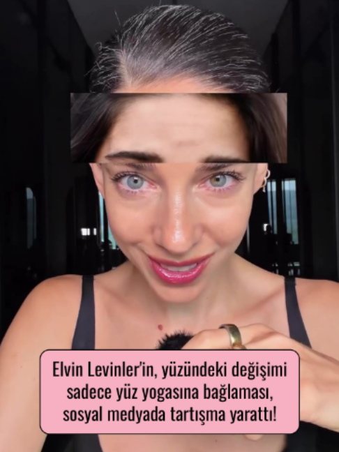 @Mynet Kadin