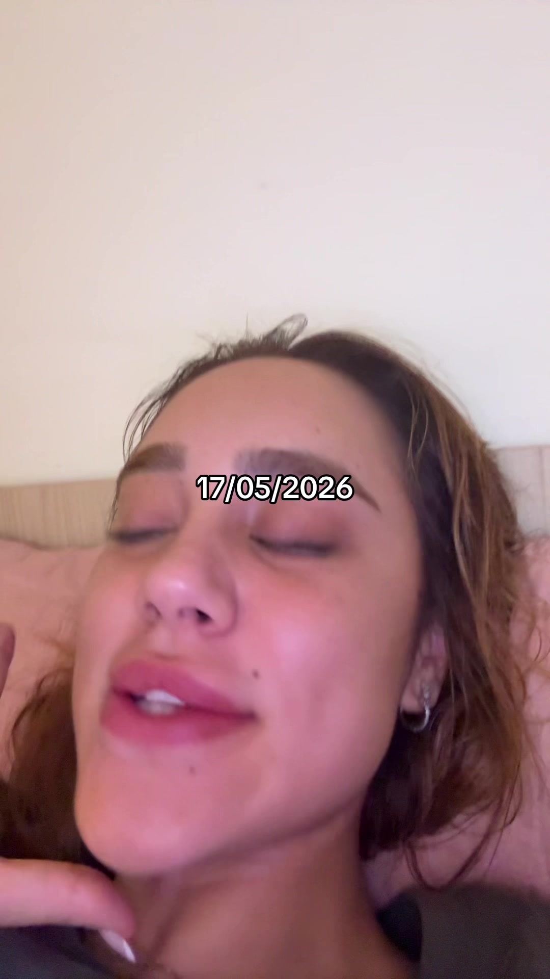 @777