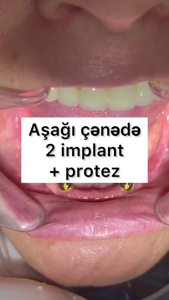 @eltakindentistry