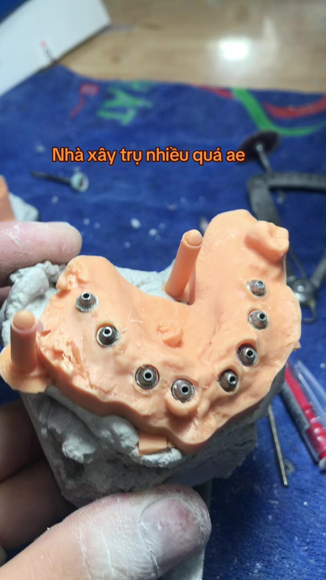 @H&ugrave;ng răng sứ 🦷🦷