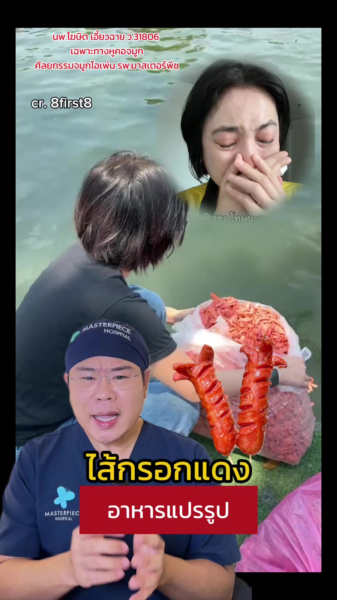 @หมอเบ็นซ์ มาสเตอร์พีซ