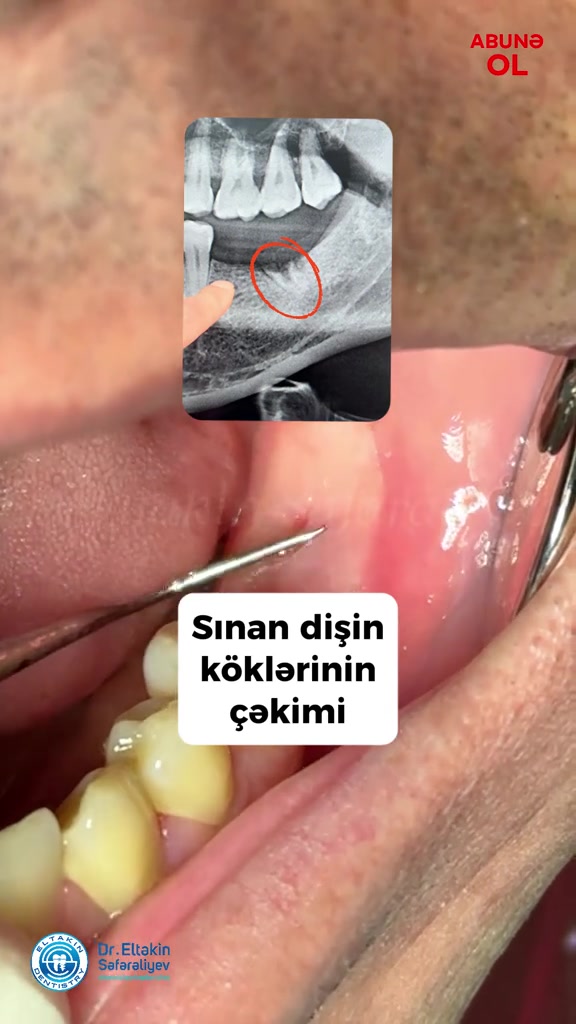 @eltakindentistry