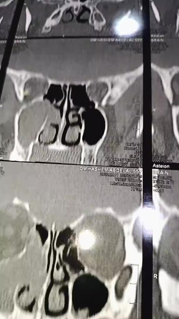 @د_أحمد الزحزاحي Dr/Ahmd zhzahy