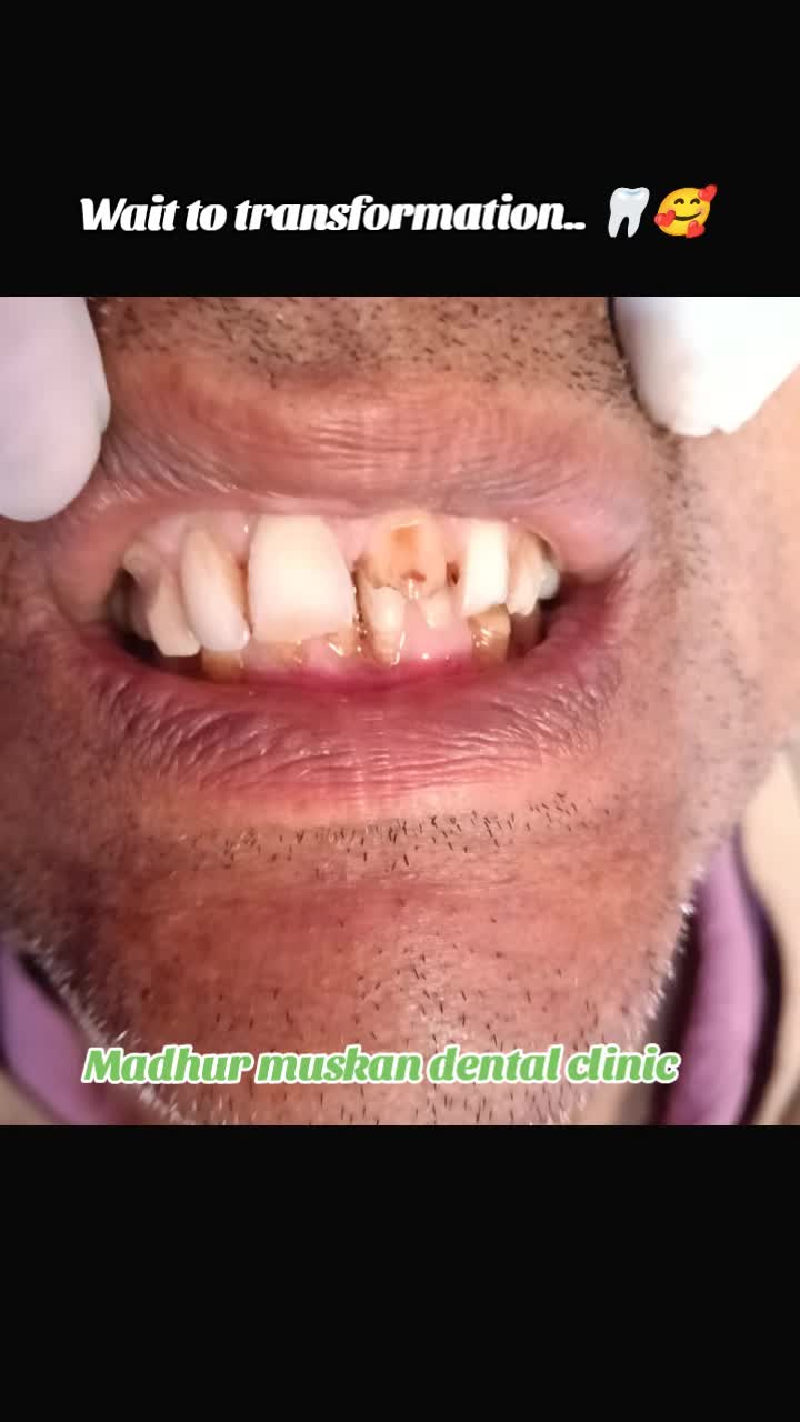 @Ramakrishna yadav 🦷🩺