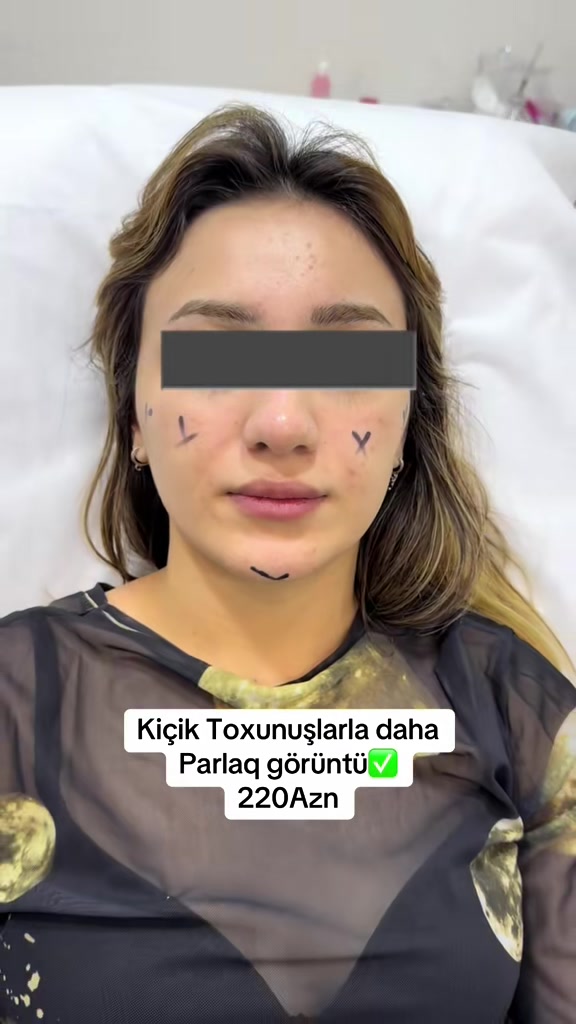 @Kosmetoloq_G&uuml;l&uuml;_Rajab