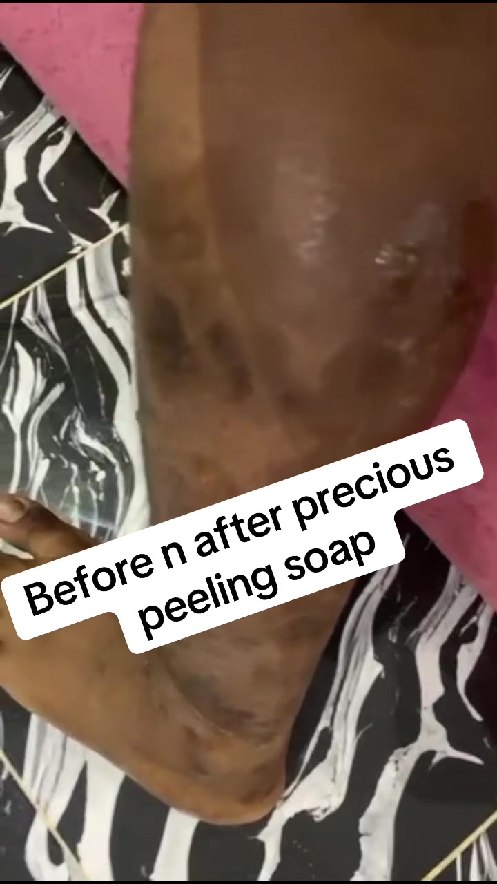 @@ Precious peeling soap