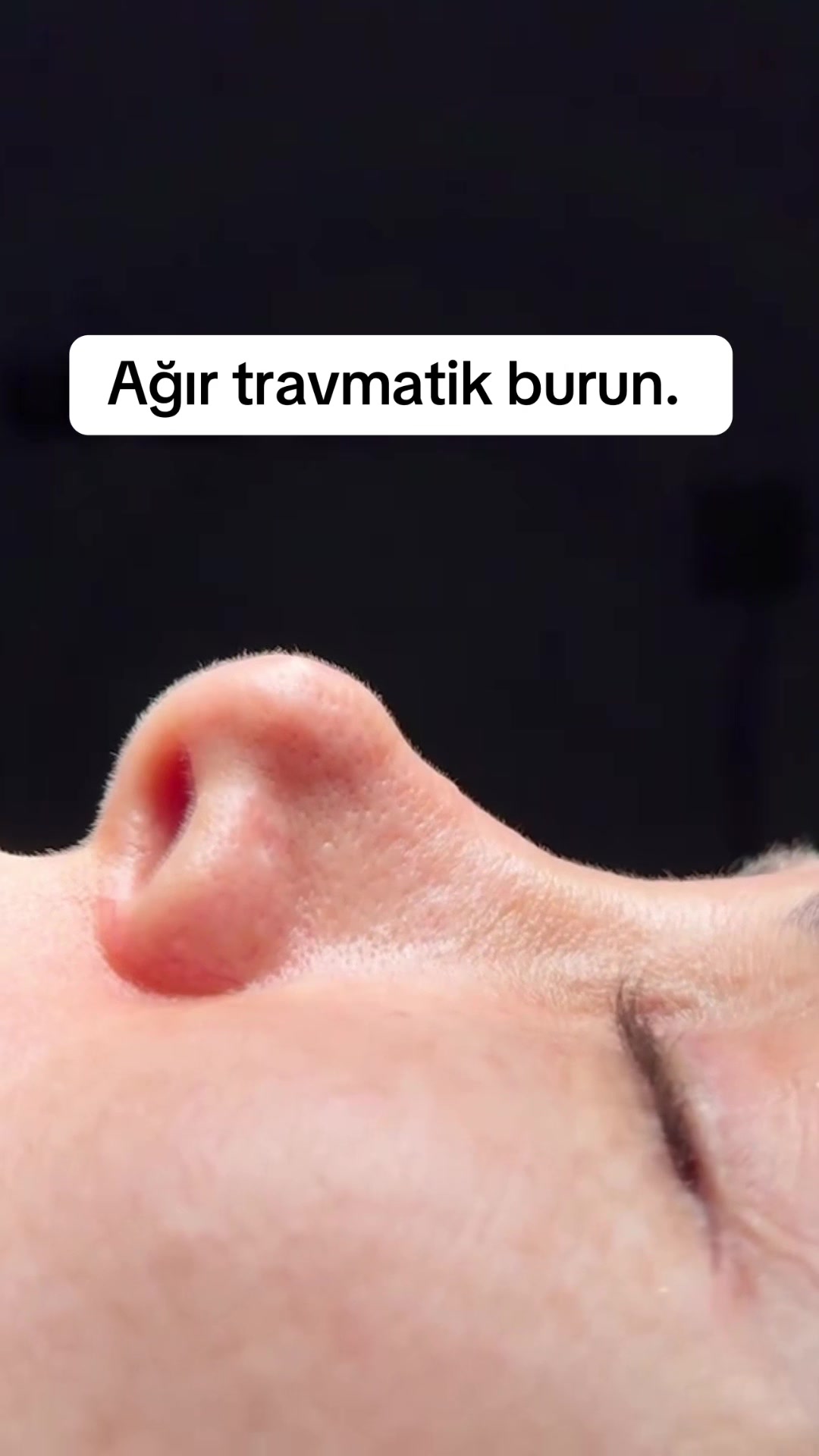 @Estetik_cerrah