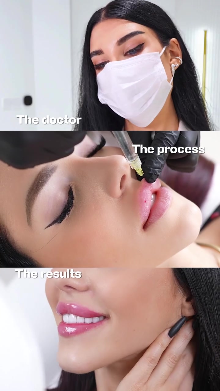 @Lips_for_kiss