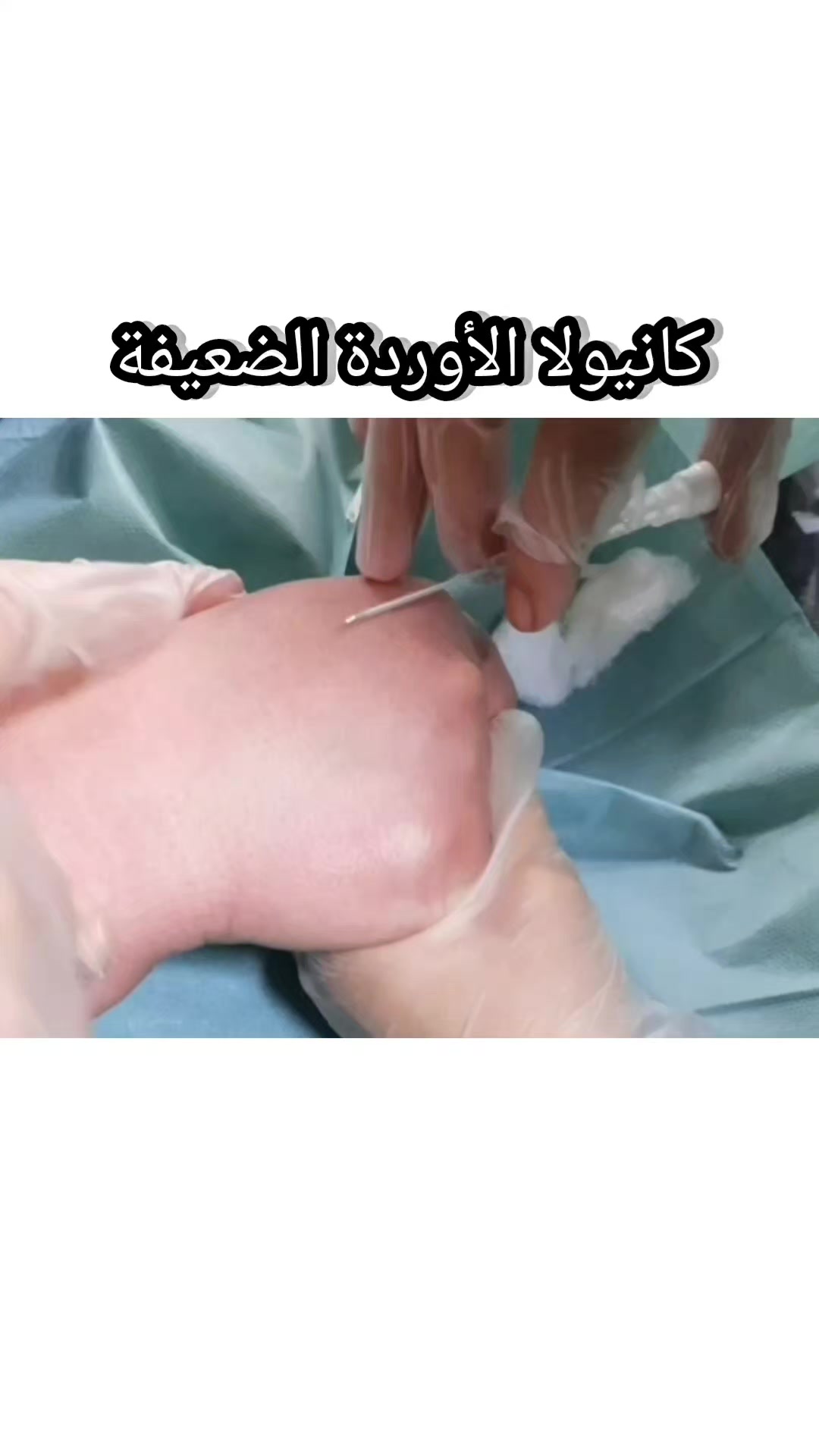 @Nexora Anesthesia