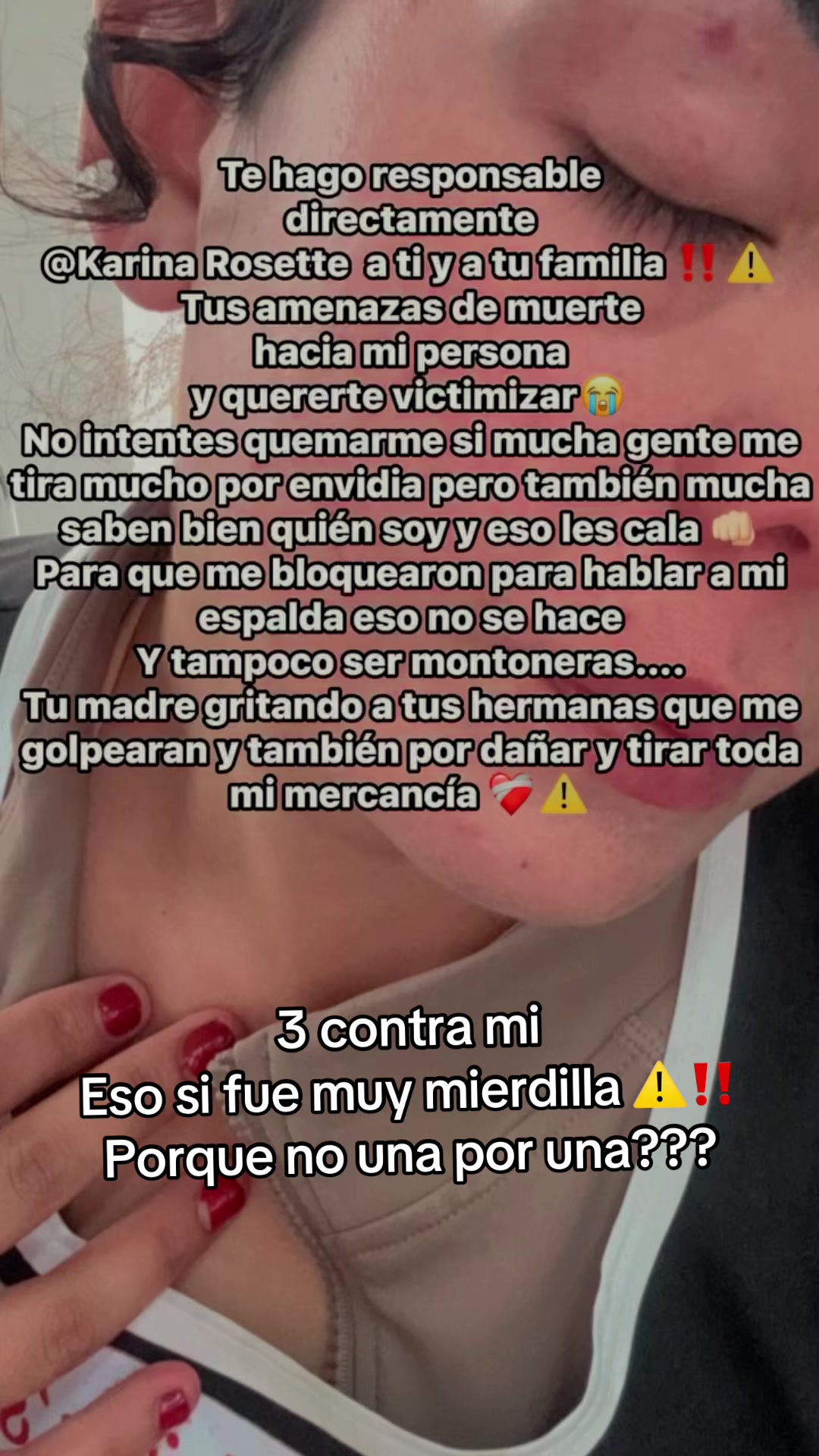 @𝓛𝓪 𝓒𝓱𝓲𝓷𝓪 Fresita🍓