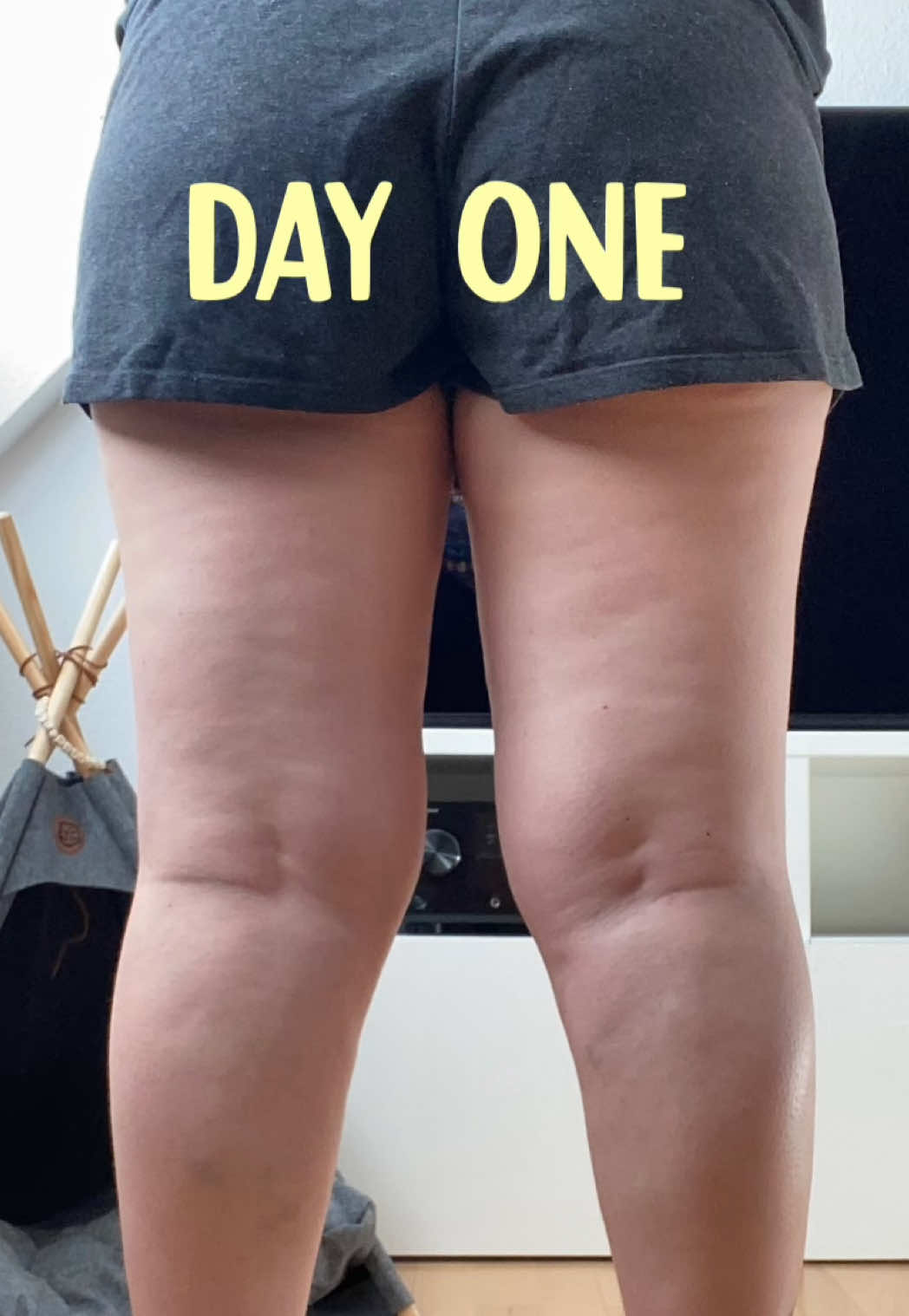 @maike | lipödem | ootd