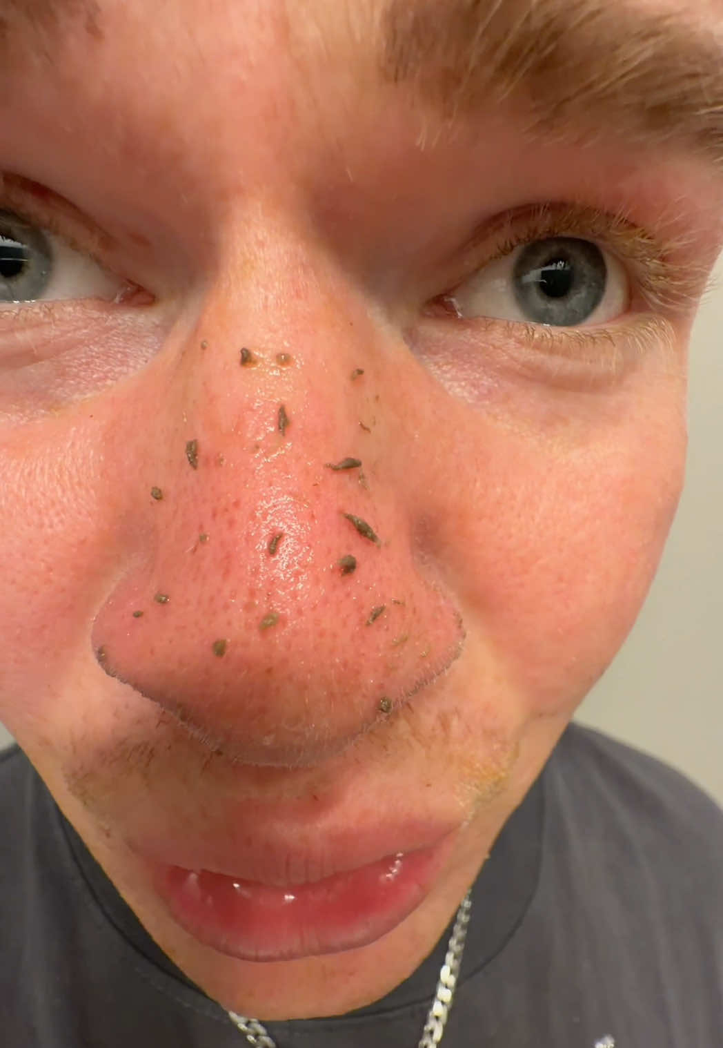 @Preston