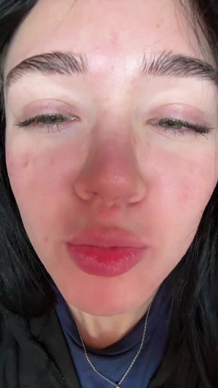 @lilly