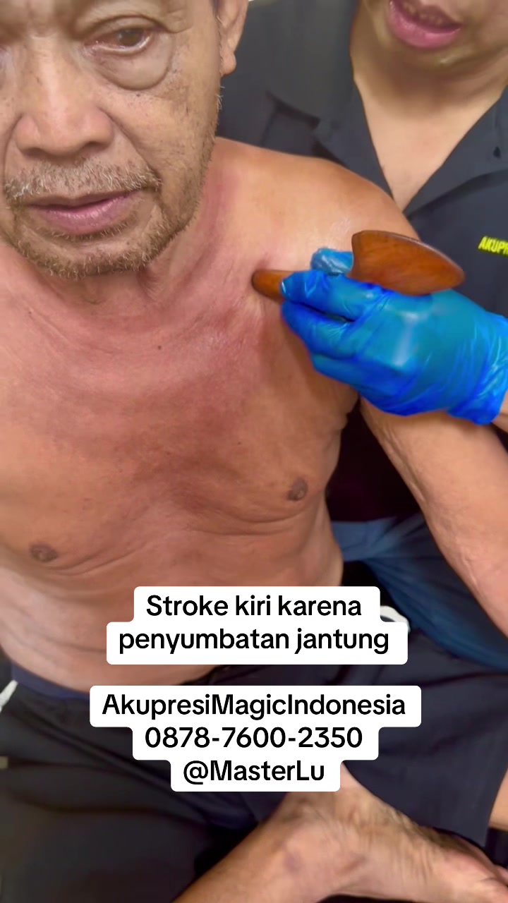 @Luki Trihartawan
