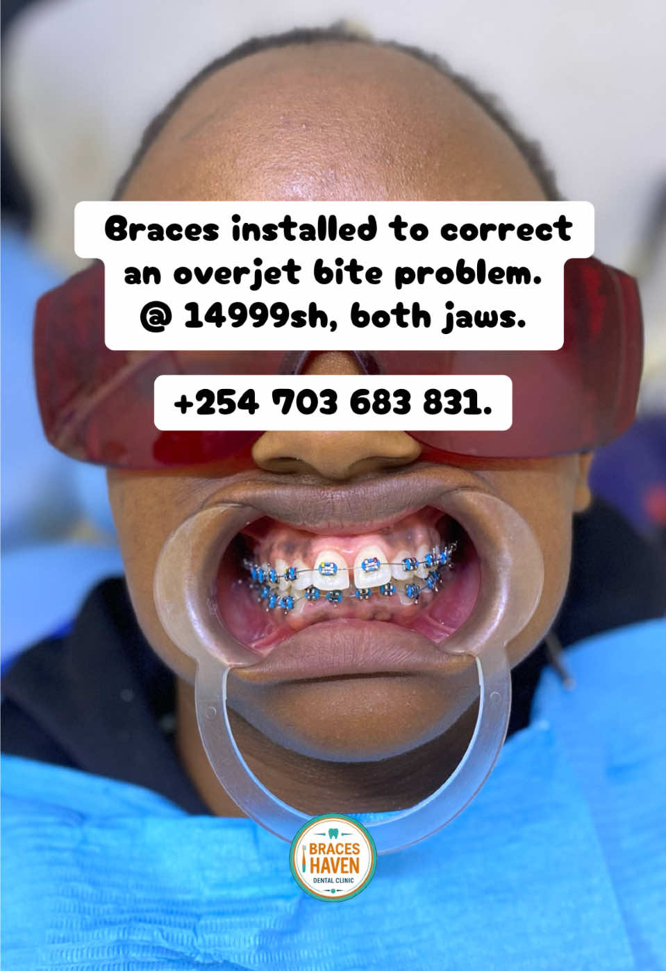 @Braces Haven Nairobi Dental