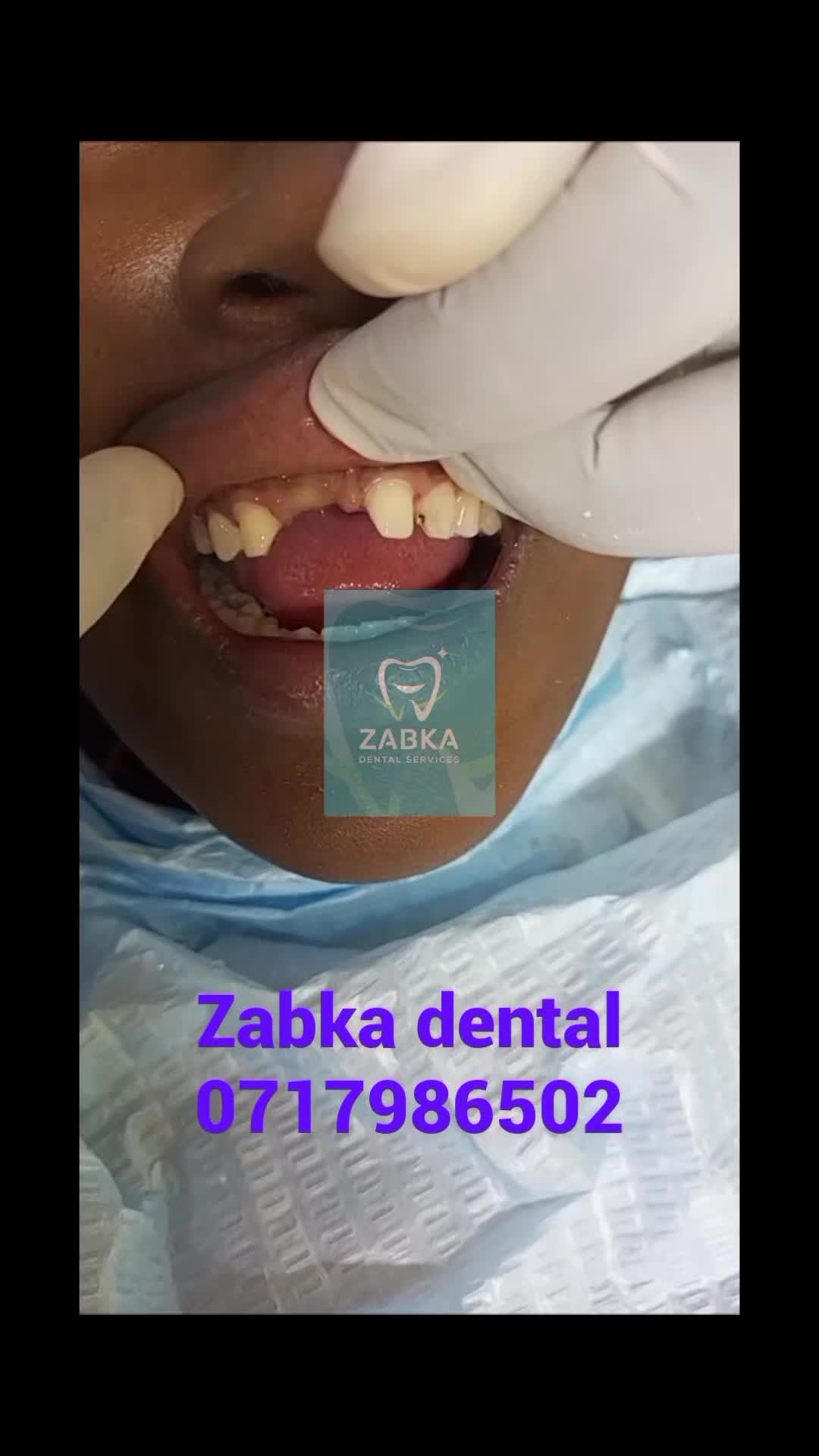 @Zabka Dental