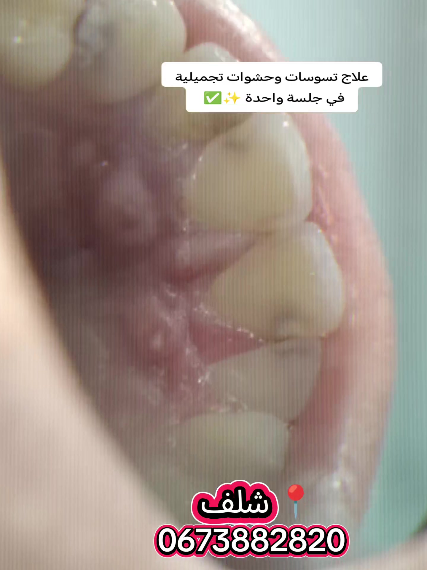 @Dr HASSOUN02 طبيبة الاسنان شلف