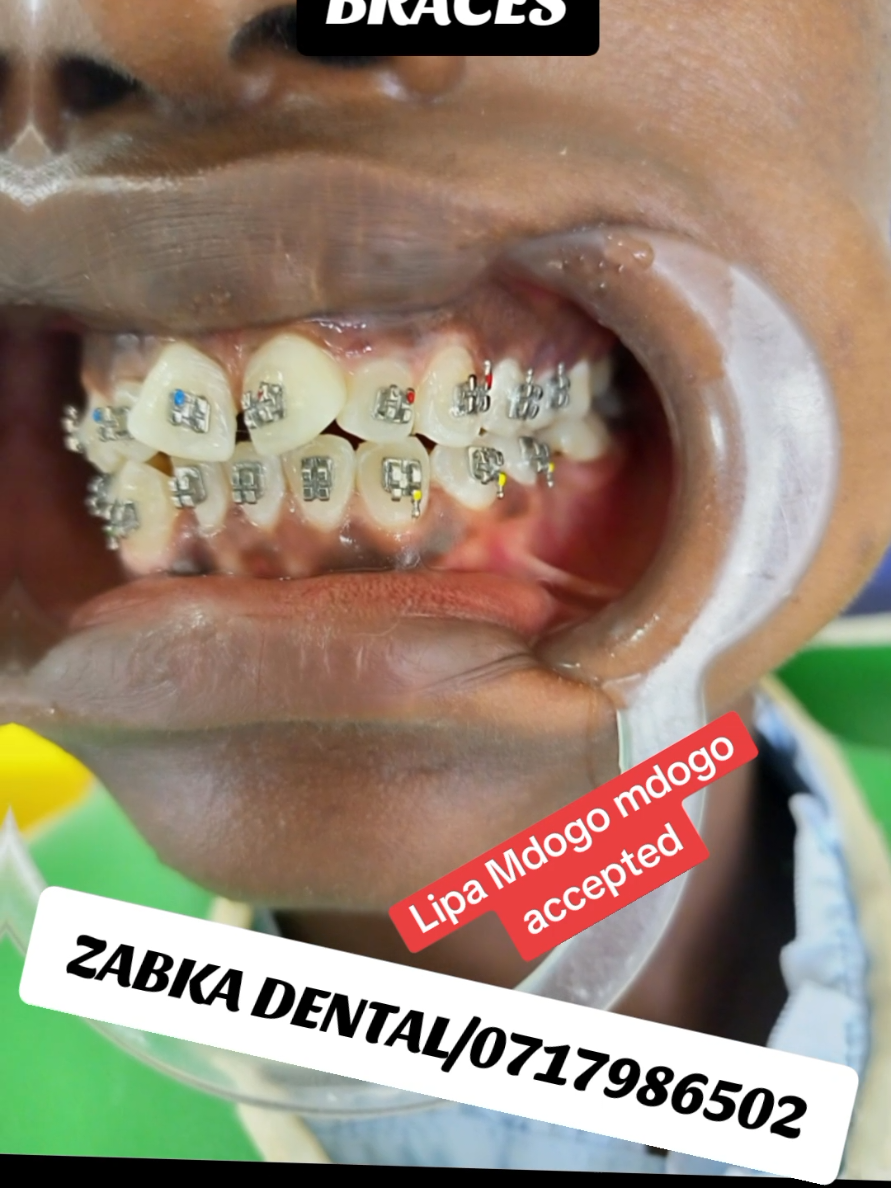 @Zabka Dental