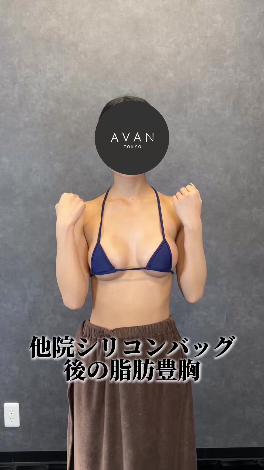 @SHIN/森脇 進の二の腕脂肪吸引・豊胸