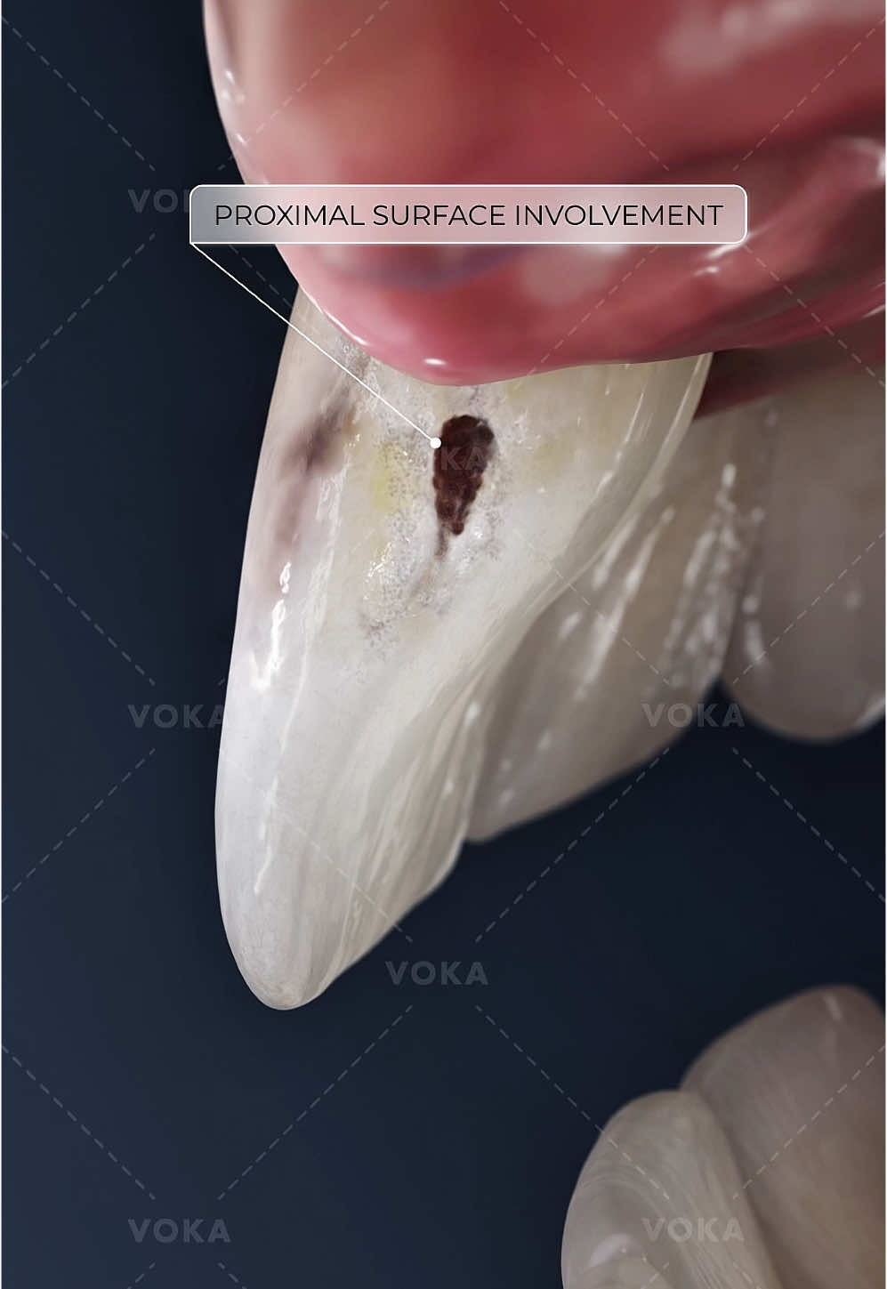 @VOKA 3D Anatomy & Pathology