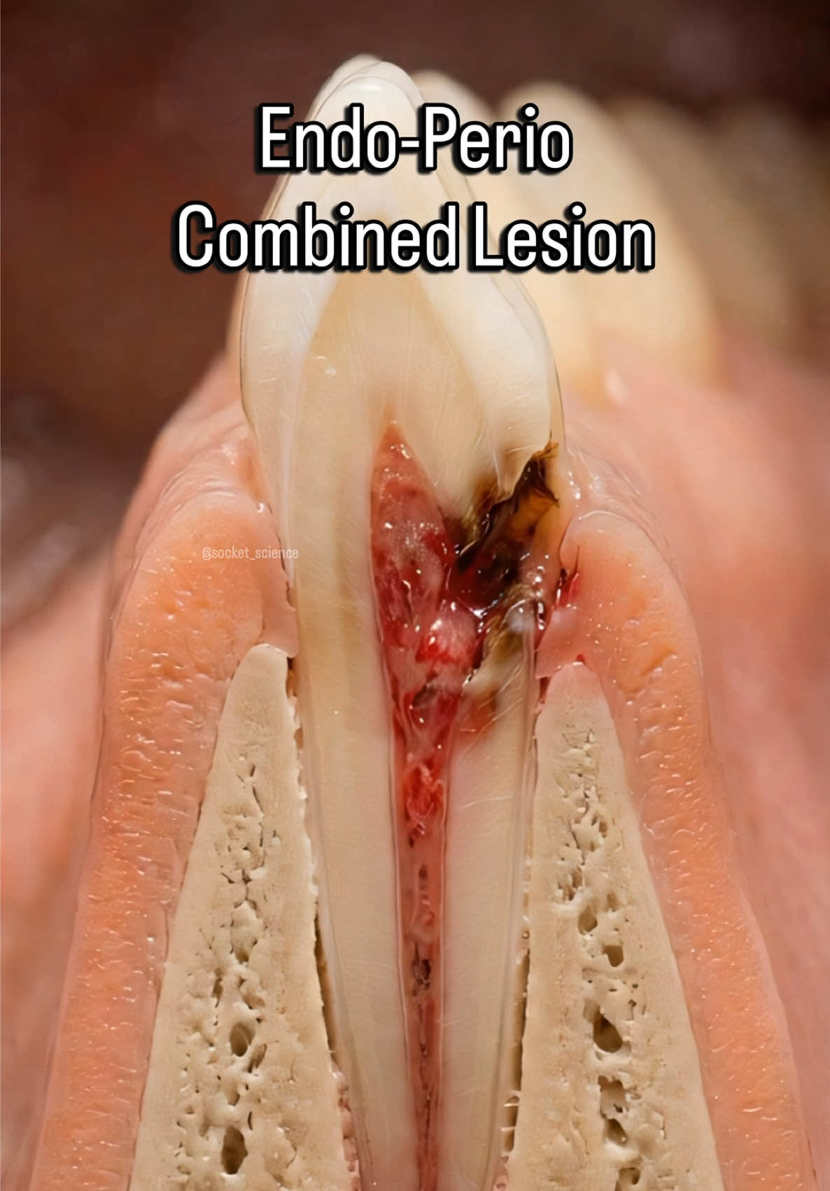 @Socket Science | Dental Visual