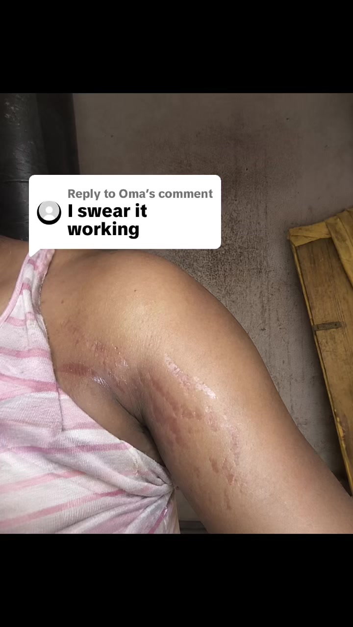 @Radiant skin