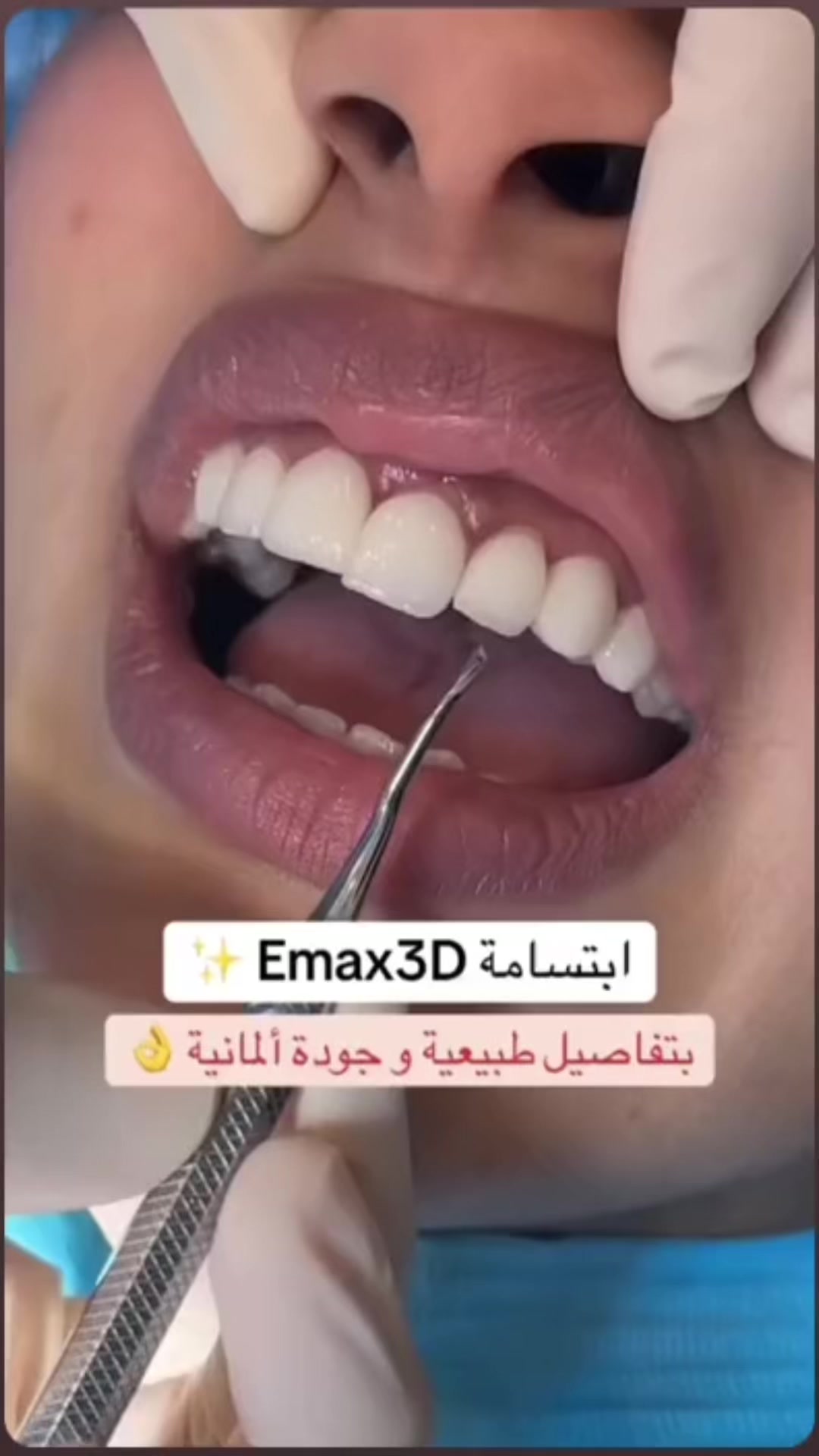 @Dr.ranaalsilani