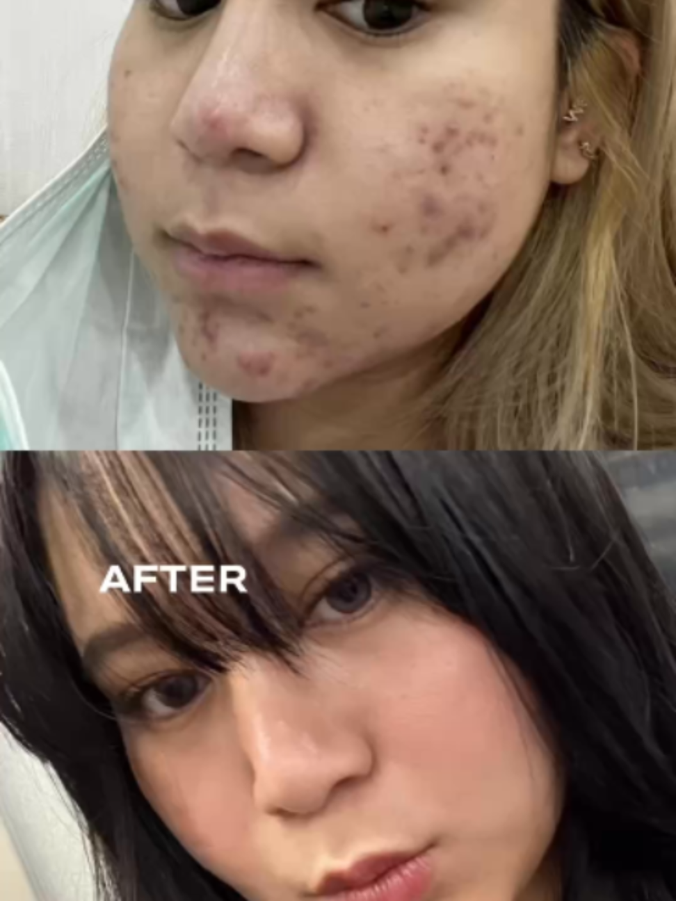@Standard Skin clinic