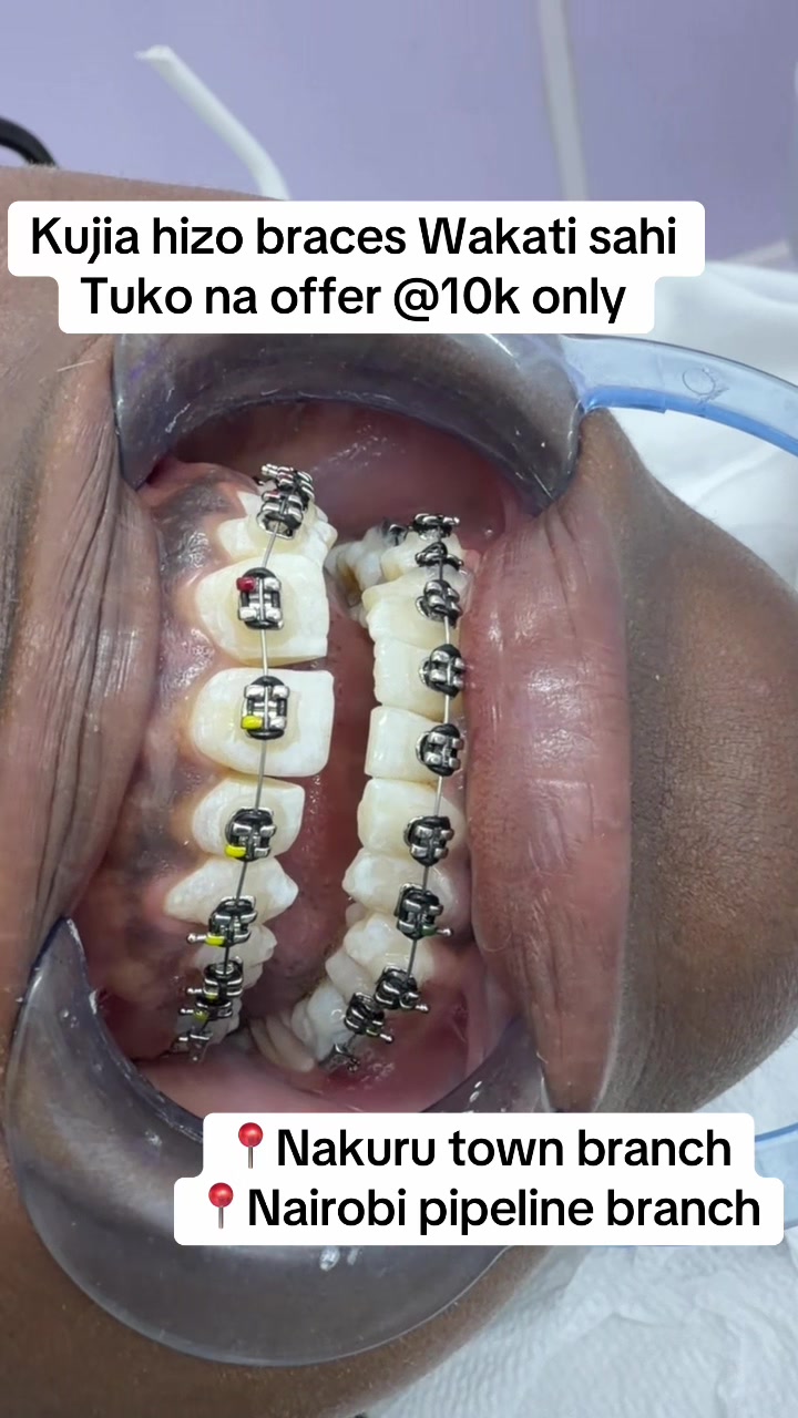@Tiba dental care