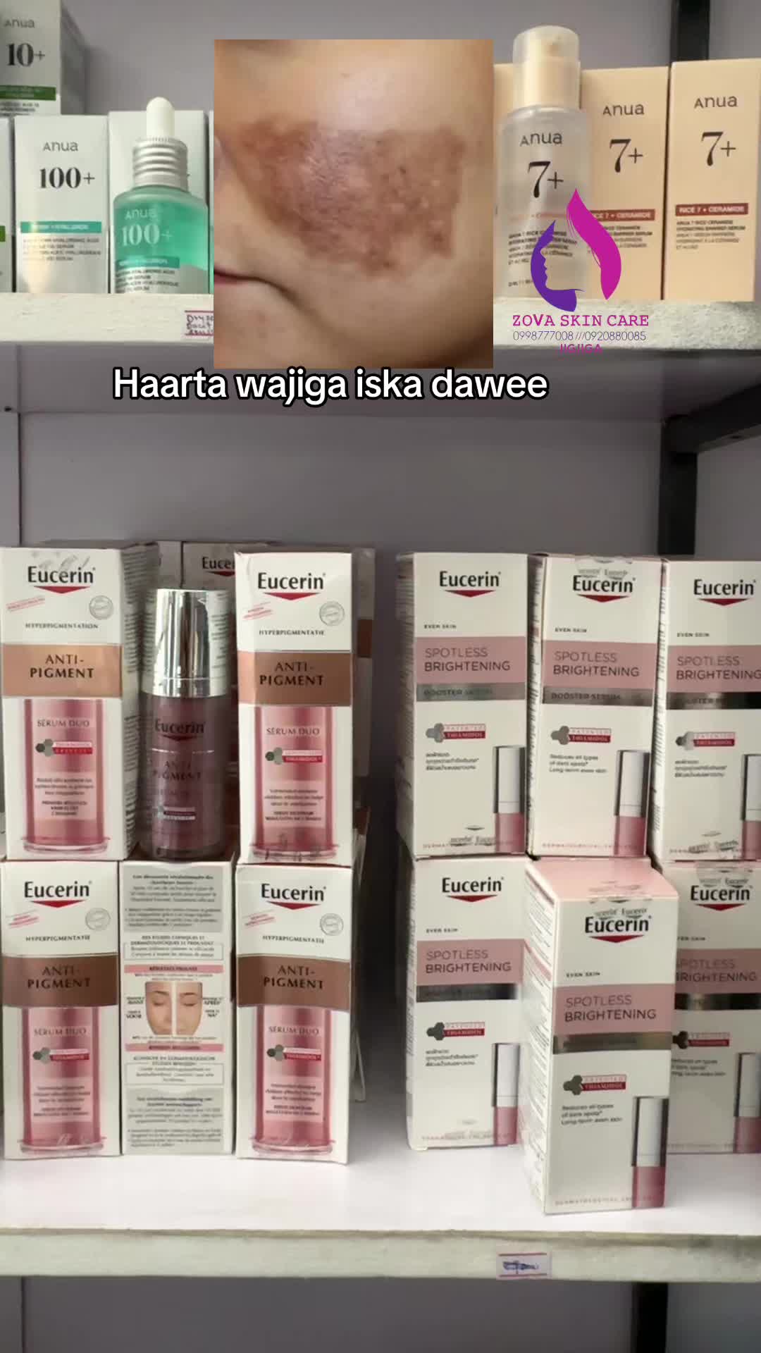 @ŽOVA ŜKIN Č̣ARE