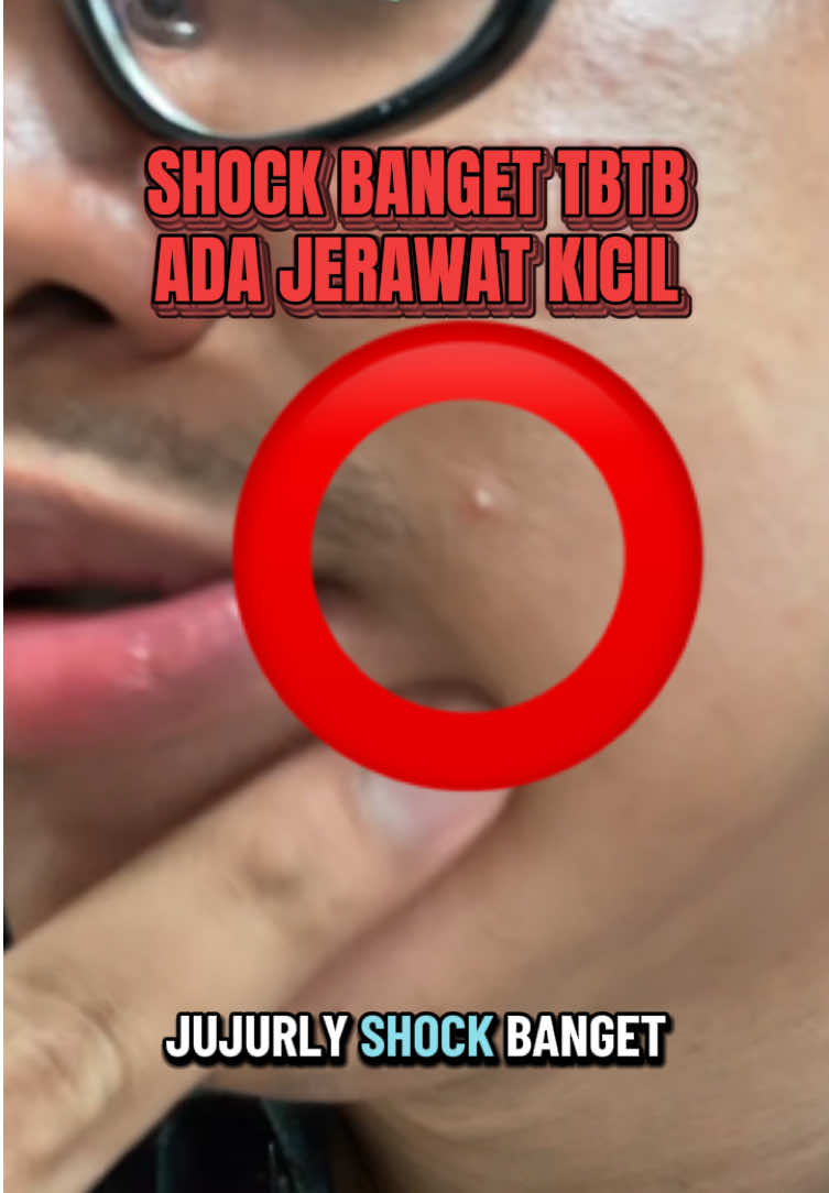 @ficky