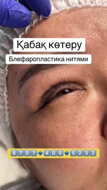 @Стоматология, Блефаро, ПМ 🇰🇿