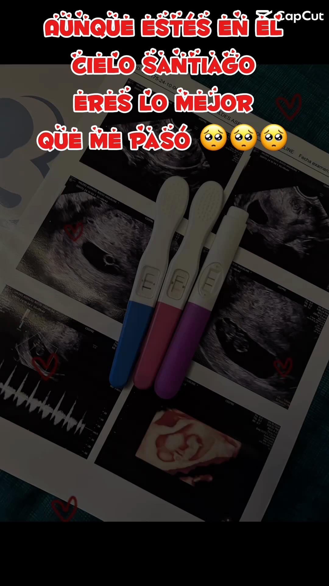 @RJVA