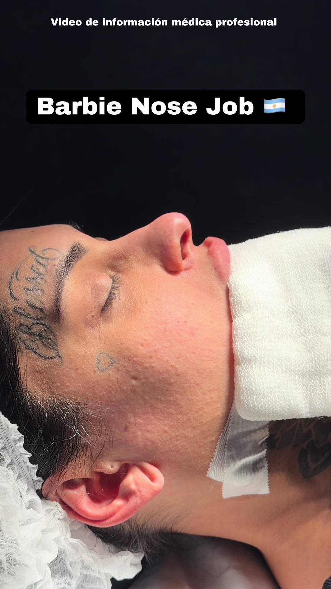@drgarone.rinoplastia