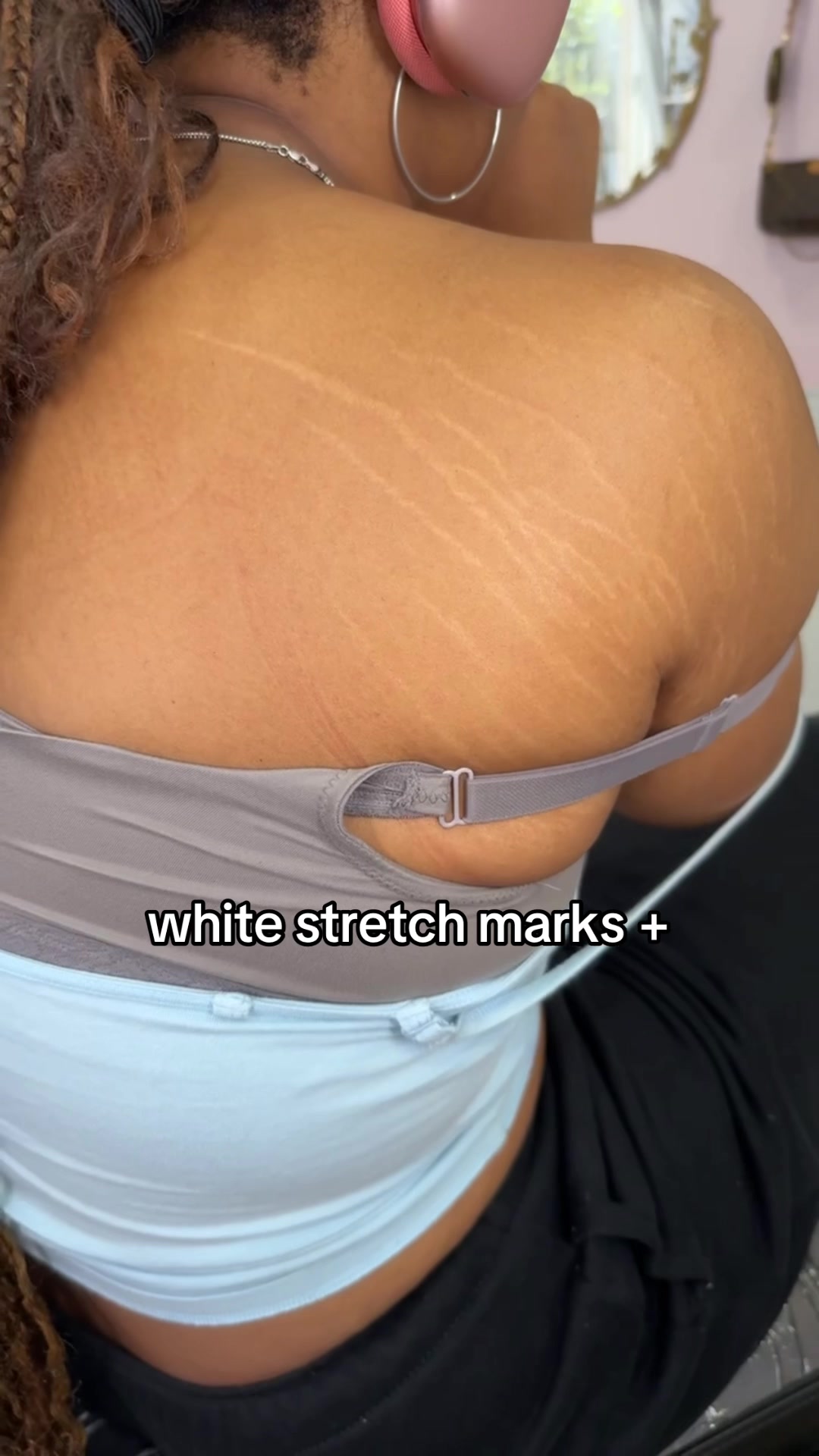 @Stretch Mark Fairy 🧚✨