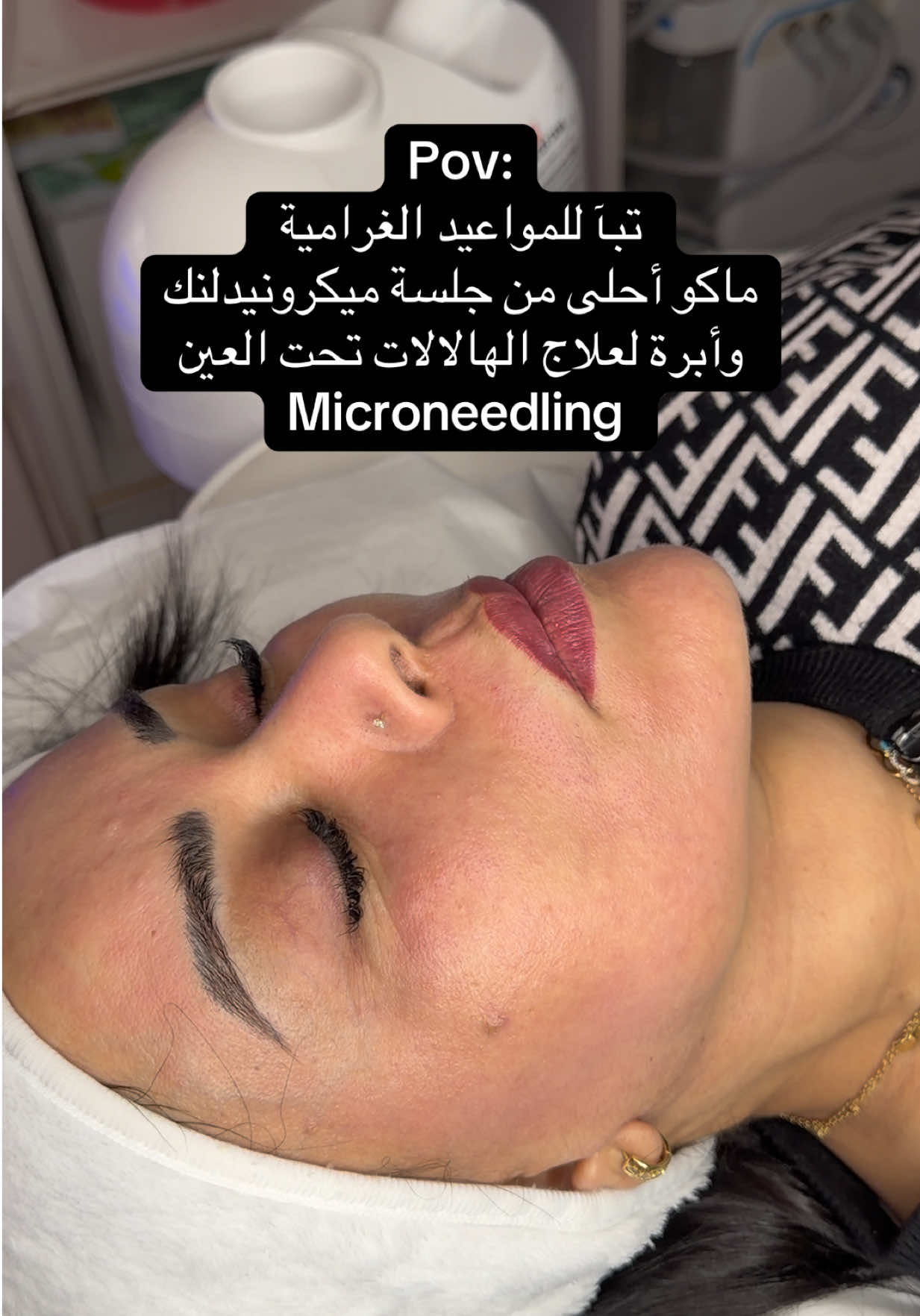 @Aya Alkhafaji
