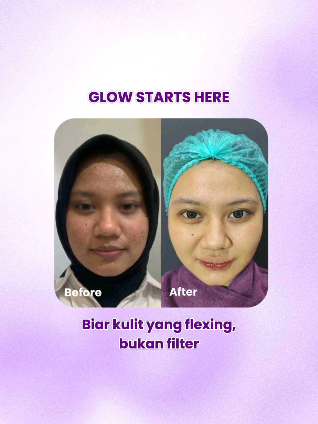 @Leny Skincare Karawaci