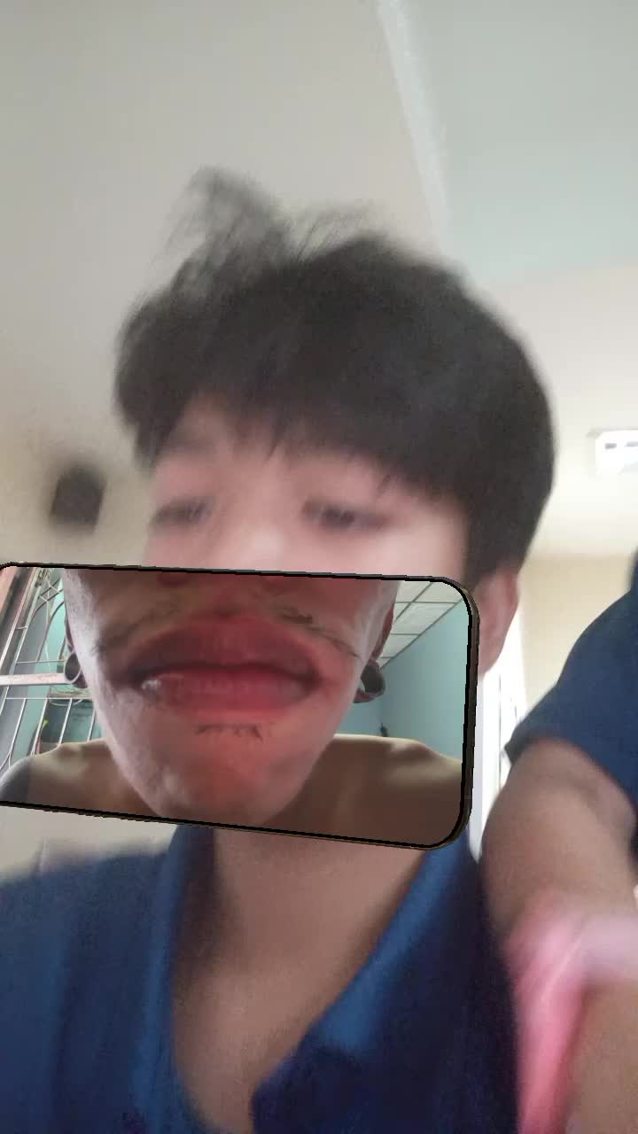 @ลอพอ