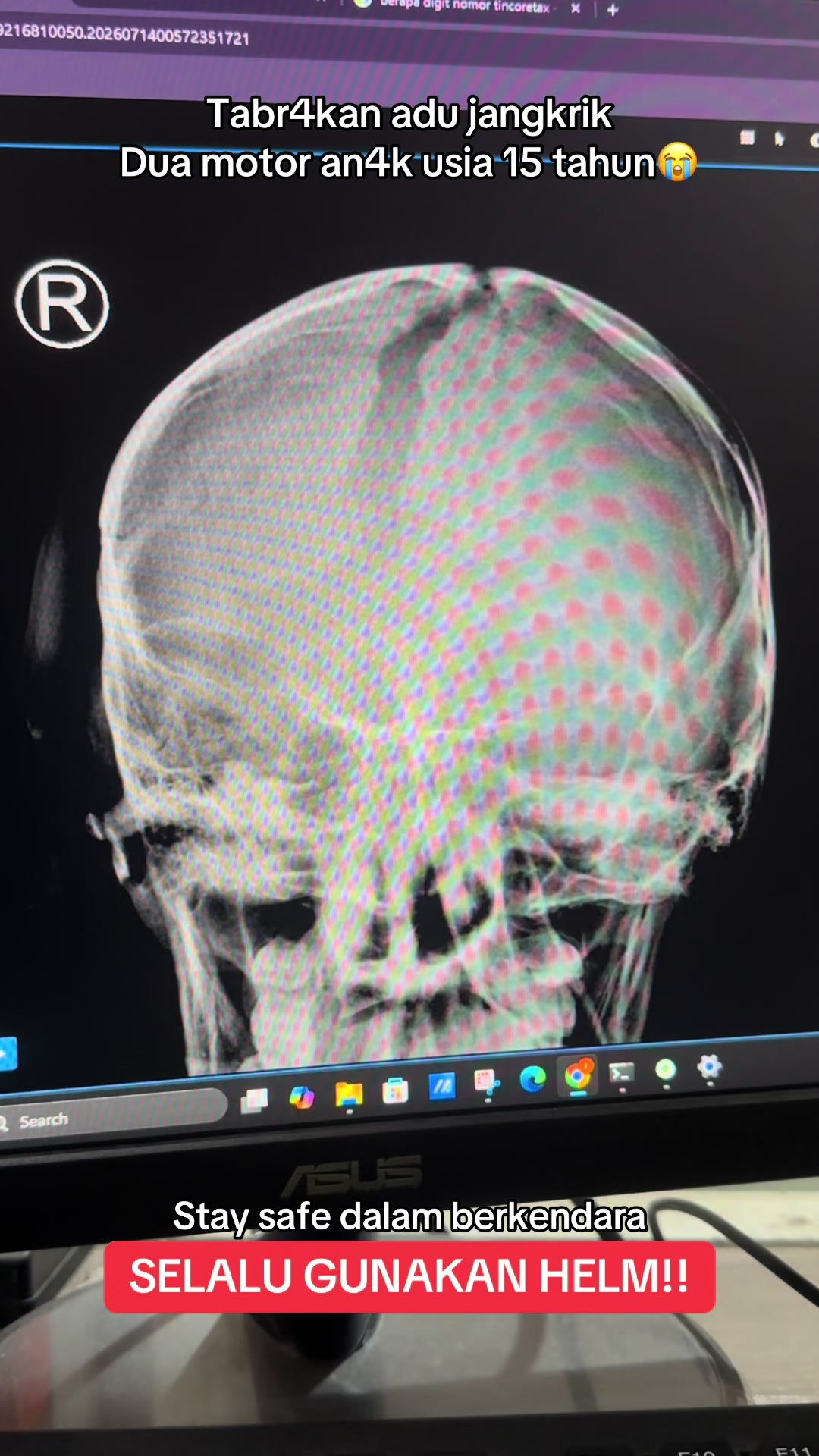 @Sobat Radiology