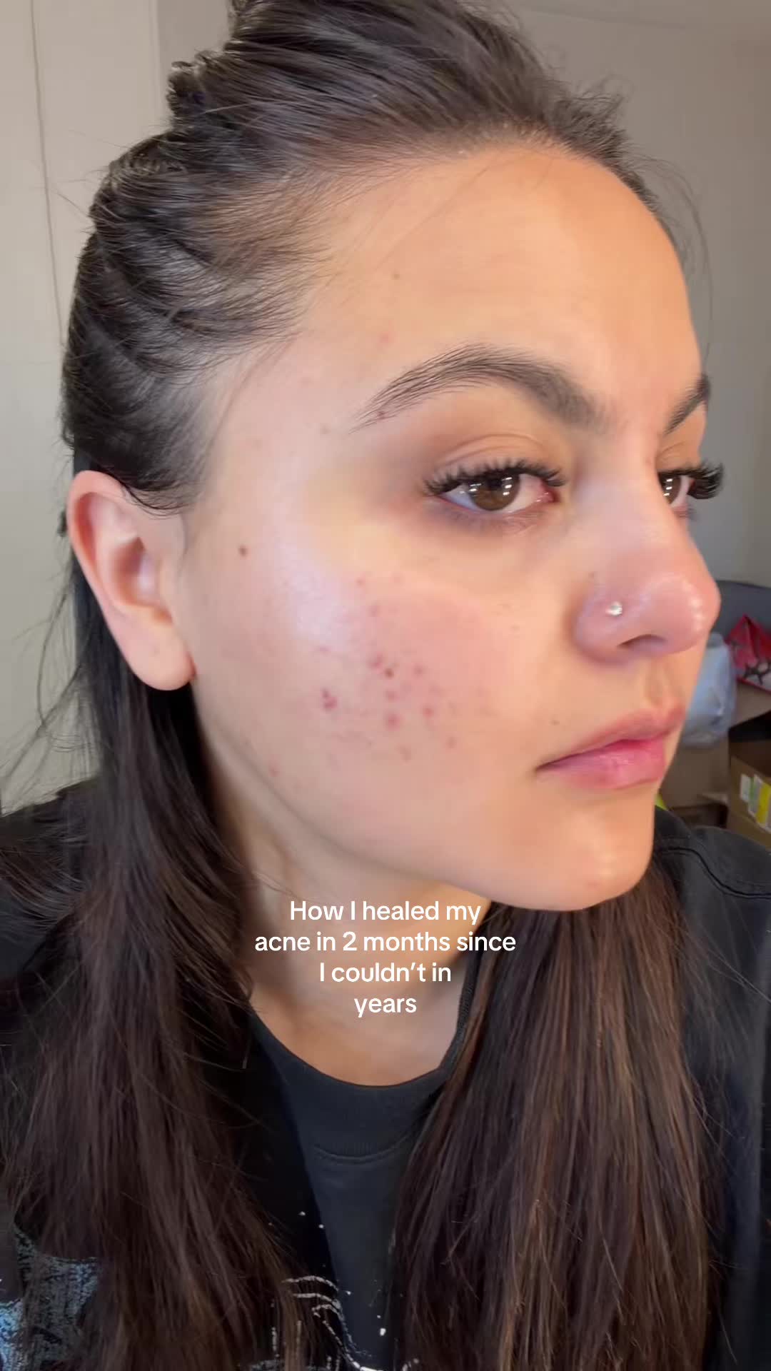 @Yohana Ortiz