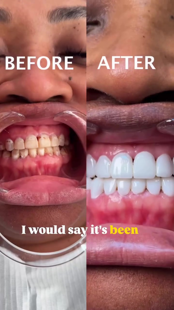 @Whiten Lighten TAC